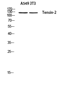 Tensin-2 Polyclonal Antibody