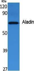 Aladin Polyclonal Antibody