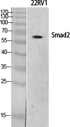 Smad2 Polyclonal Antibody