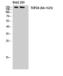 Topo IIα Polyclonal Antibody