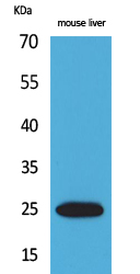 CRP Polyclonal Antibody