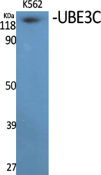 UBE3C Polyclonal Antibody