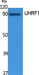 UHRF1 Polyclonal Antibody