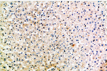 MIP-5 Polyclonal Antibody