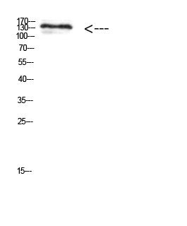 MIB1 Polyclonal Antibody