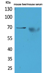 AFP Polyclonal Antibody