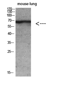 Keratin-pan Polyclonal Antibody