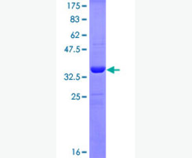 Recombinant Human POMGNT1