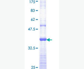 Recombinant Human C-C Motif Chemokine 16/CCL16