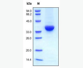 Recombinant Human Microtubule-Associated Protein Tau F/MAPT-F/TAU-F