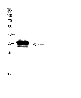 Pan myristoylation Polyclonal Antibody