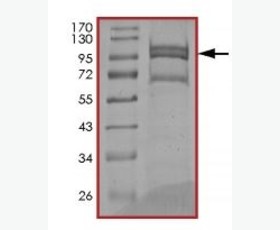 Recombinant Human Lipopolysaccharide-Binding Protein/LBP