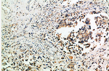 Tubulin γ Polyclonal Antibody