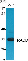 TRADD Polyclonal Antibody