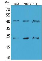 TMEM173 Polyclonal Antibody