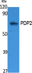 PDP2 Polyclonal Antibody