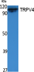 TRPV4 Polyclonal Antibody