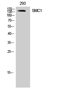 SMC1 Polyclonal Antibody