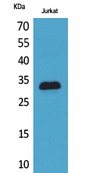 p57 Polyclonal Antibody