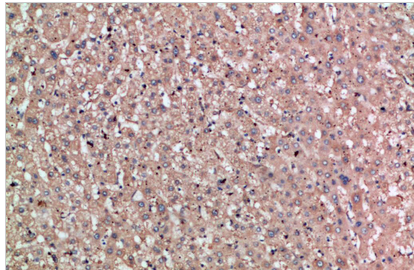 Noggin Polyclonal Antibody