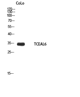 TCEAL6 Polyclonal Antibody