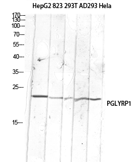 PGLYRP1 Polyclonal Antibody