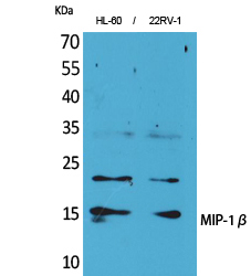 MIP-1β Polyclonal Antibody