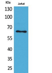 Keratin-pan Polyclonal Antibody