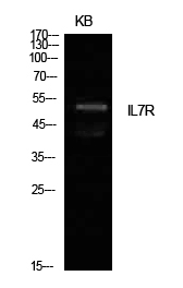 IL-7R Polyclonal Antibody