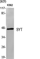 SYT Polyclonal Antibody