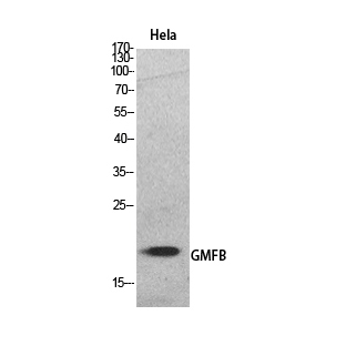 GMF-β Polyclonal Antibody