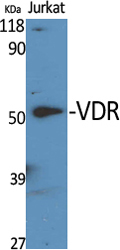 VDR Polyclonal Antibody