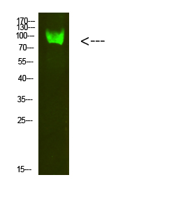 Catenin-β Polyclonal Antibody