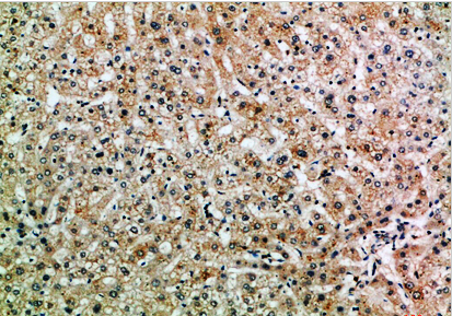 ASPP1 Polyclonal Antibody