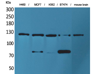 CD56 Polyclonal Antibody