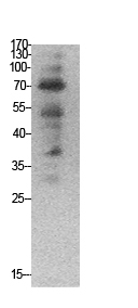 Ub Polyclonal Antibody