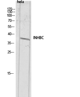 Inhibin β-C Polyclonal Antibody