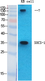 SOCS-1 Polyclonal Antibody