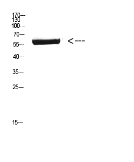 CYP26B1 Polyclonal Antibody