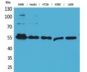 Fascin 1 Polyclonal Antibody