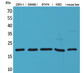 VEGF-A Polyclonal Antibody