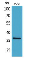 JAM-A Polyclonal Antibody