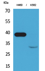 Cathepsin L Polyclonal Antibody