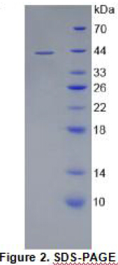 Recombinant Cluster Of Differentiation 4 (CD4)