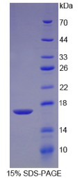 Recombinant Transforming Growth Factor Beta 2 (TGFb2)