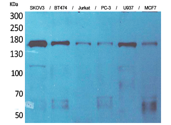 SCP-2 Polyclonal Antibody