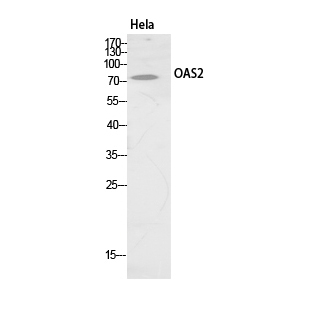 OAS2 Polyclonal Antibody