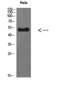 ETBR Polyclonal Antibody