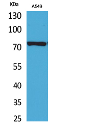 p73 Polyclonal Antibody