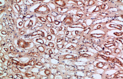 Tetranectin Polyclonal Antibody